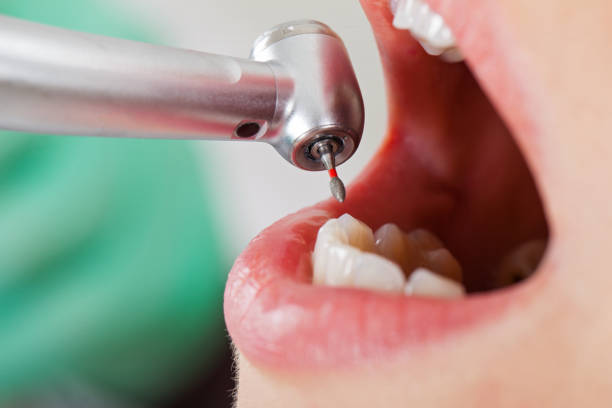 Best Emergency Dental Care for Abscessed Tooth in Eustace, TX